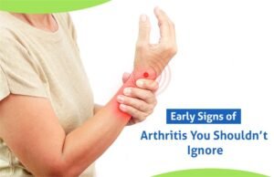 signs of arthritis
