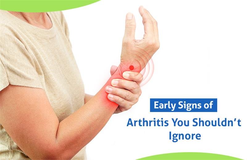 signs of arthritis