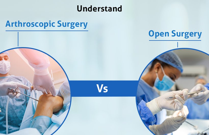 arthroscopic surgery vs open surgery