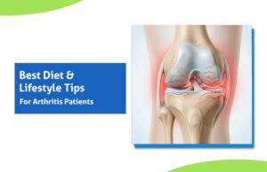 Best Diet & Lifestyle Tips for Arthritis Patients