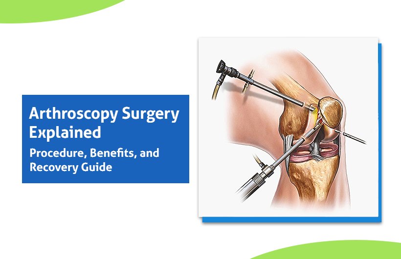 Arthroscopy Surgery Explained: Procedure, Benefits, and Recovery Guide