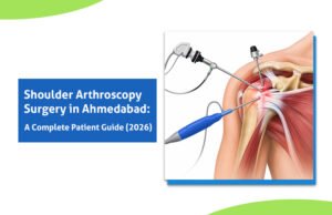 Shoulder Arthroscopy Surgery in Ahmedabad