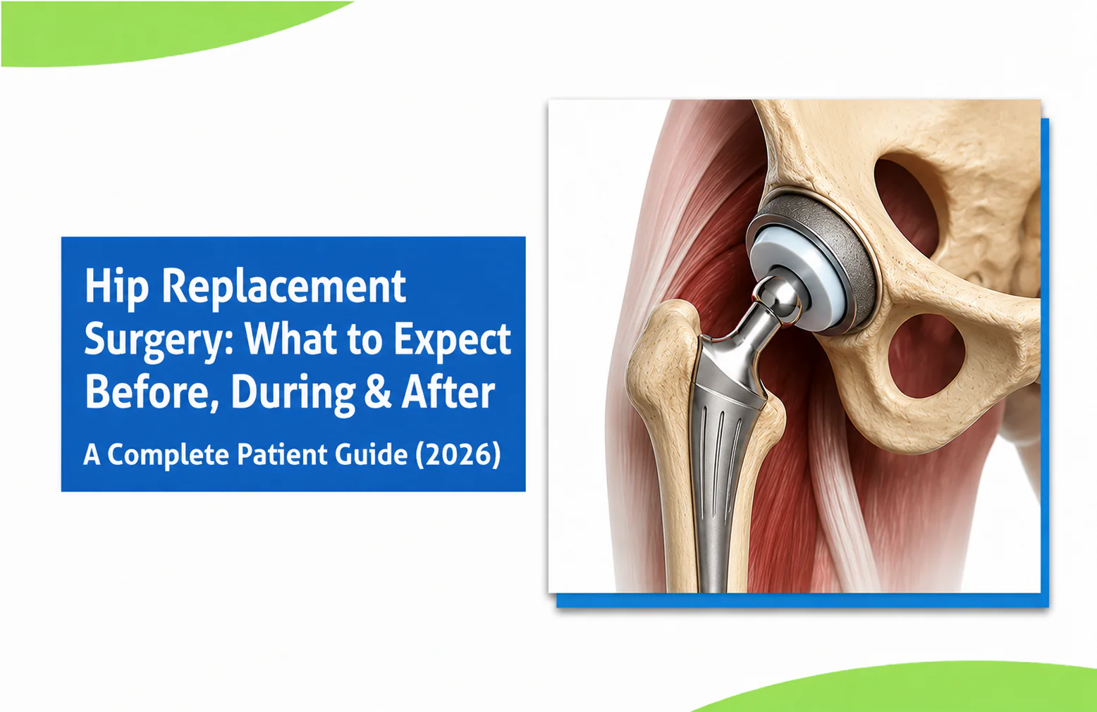 Hip Replacement Surgery: What to Expect Before, During & After