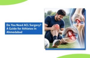 ACL Tear Treatment in Ahmedabad