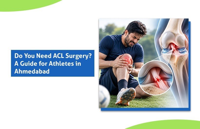 ACL Tear in Athletes: Do You Need Surgery, or Can You Recover Without It?