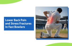 Lower Back Pain in Fast Bowlers